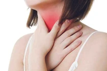 Hội chứng tắc họng thanh quản