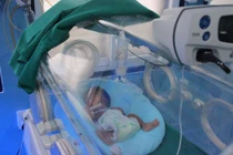 Hội chẩn cùng tuyến trung ương cứu trẻ uốn ván rốn ngừng thở