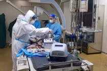 Can thiệp nút mạch điều trị ho ra máu ở bệnh nhân Covid-19