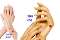 Vê ngón tay trị viêm gân cơ bàn tay