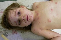 Con mắc bệnh mới hối hận