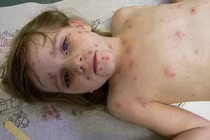 Con mắc bệnh mới hối hận