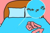 Tác hại của việc mặc đồ ngủ quá 2 ngày