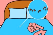 Tác hại của việc mặc đồ ngủ quá 2 ngày