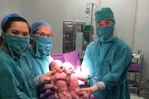 Sinh đôi cùng trứng ra đời nhờ thụ tinh ống nghiệm