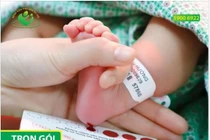 Hội chứng suy giảm miễn dịch tổ hợp SCID