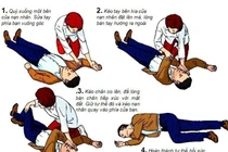 Sơ cứu sai hại chết người đột quỵ