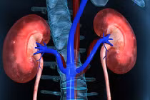 Hội chứng Alport dẫn đến suy thận