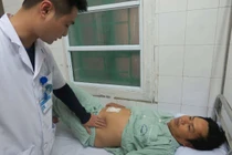 Dị vật xương cá đâm thủng ruột non