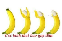 Vệ sinh bao quy đầu đúng cách