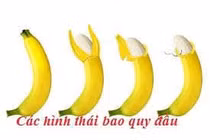 Vệ sinh bao quy đầu đúng cách