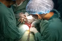 Rau cài răng lược cần theo dõi sát