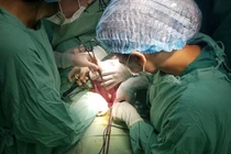 Rau cài răng lược cần theo dõi sát