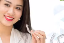 Rơi mắc cài khi chỉnh răng