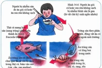 Gan to do sán lá gan nhỏ