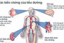  Nguyên nhân dẫn tới bệnh tim mạch ở người đái tháo đường