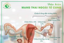 Dấu hiệu mang thai ngoài tử cung