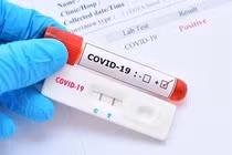 Lý giải thời gian tái nhiễm Covid-19 mỗi người mỗi khác