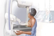 Ngộ nhận ung thư tự khỏi và những cơ hội điều trị bị bỏ qua