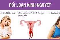 Thuốc chữa rối loạn kinh nguyệt, liệt âm