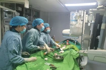 Tưởng đau bụng thông thường, người đàn ông 50 tuổi suýt chết vì lóc tách động mạch chủ phức tạp