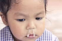 Hút mũi bằng miệng