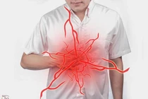 Cảnh giác với cơn đau vùng thượng vị 