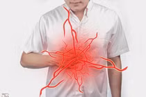 Cảnh giác với cơn đau vùng thượng vị 