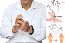 Day bấm huyệt chữa say tàu xe hiệu quả