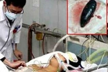 Bị suy đa tạng nghiêm trọng vì ăn phần cực nguy hiểm của cá, nhiều người cũng thích ăn nó