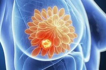 Tìm ra chất gây độc cho tế bào ung thư