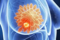 Tìm ra chất gây độc cho tế bào ung thư