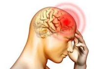 Chủ quan chóng mặt dẫn đến đột quỵ