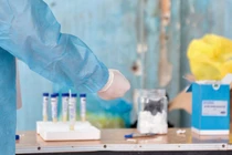 Nhân viên gom rác ở Bình Dương nhiễm SARS-CoV-2 đến nhiều nơi ở Vũng Tàu