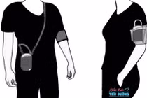 Tăng huyết áp lưu động đơn độc