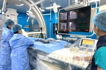 Can thiệp tim bẩm sinh tránh phẫu thuật