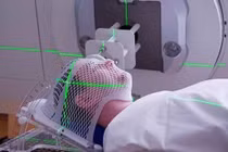 Xạ trị ở bệnh nhân ung thư làm tăng nguy cơ suy giáp và ung thư tuyến giáp