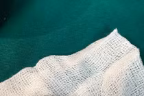 Vốc uống nước suối, đỉa chui vào mũi