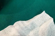 Vốc uống nước suối, đỉa chui vào mũi