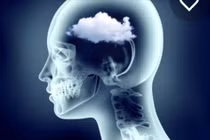 Sương mù não là 1/3 di chứng phổ biến của Covid-19