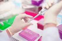 Bệnh viện Đại học Y Dược TPHCM khai trương phòng khám tư vấn di truyền 