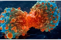 Ăn nhiều mỡ dễ bị ung thư