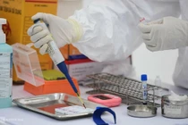 Bộ Công an: Máy xét nghiệm Covid-19 bị nâng giá 4,7 tỷ đồng
