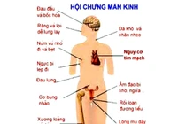Bấm huyệt tay giảm ngay triệu chứng tiền mãn kinh