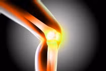 Thực phẩm phòng tránh loãng xương