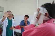 Hoãn đám cưới vì bị tạt axit