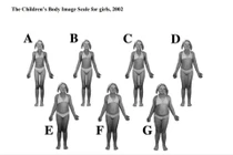 Trẻ càng thừa cân càng tăng tỷ lệ thiếu vitamin D