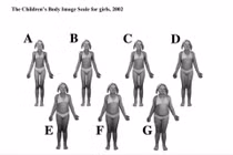 Trẻ càng thừa cân càng tăng tỷ lệ thiếu vitamin D