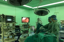 Cắt bỏ thành công khối u hiếm gặp nặng 3 kg trong ổ bụng