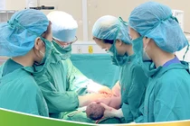 Truyền 1 lần ối cứu sống thai nhi tuần thứ 28